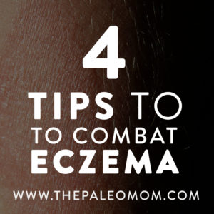 The-Paleo-Mom-4-Tips-to-Combat-Eczema